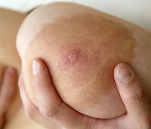Порно съемка волосатой пизды толстушки на дачном участке 53 фото